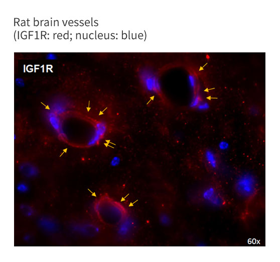 IGF1R is Highly Expressed in Brain Vessels