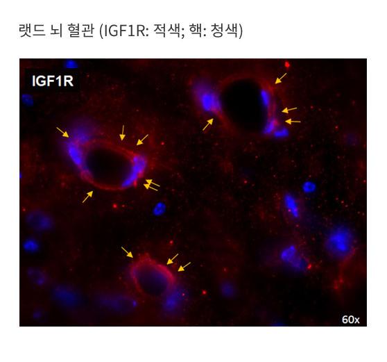 IGR1R은 뇌 혈관에 다수 출현